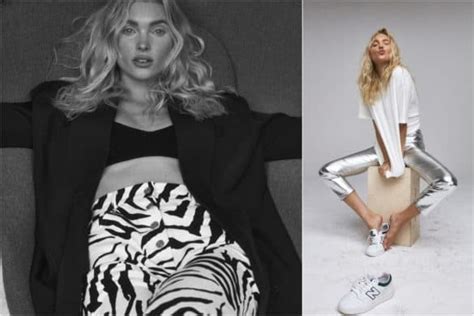 An Inspiration to Many: Elsa Hosk's Philanthropic Endeavors and Advocacy