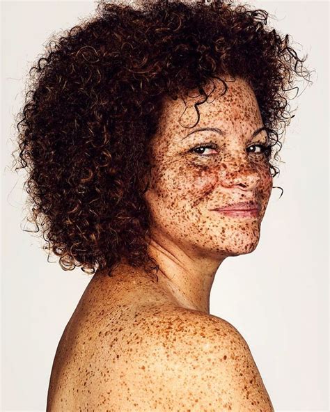 The Rise of Freckles 18: Achievements and Recognition