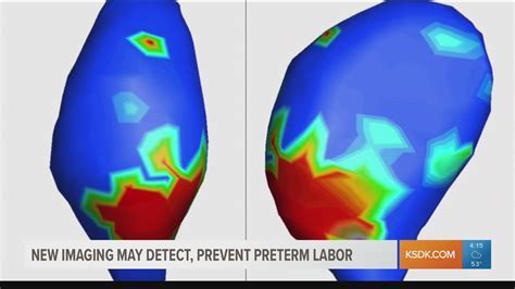 Understanding the Physique and Body Measurements of Emmi Accel